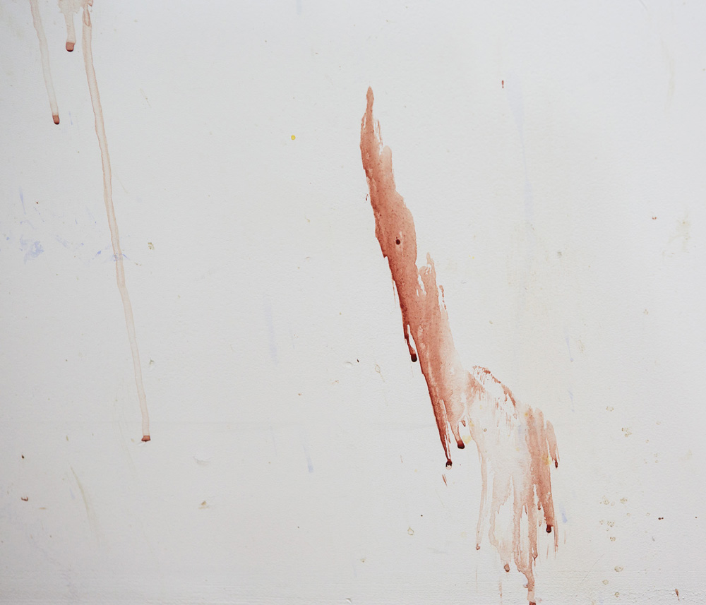 It Will Hurt A Little — Operating Theater, Details, A Wall